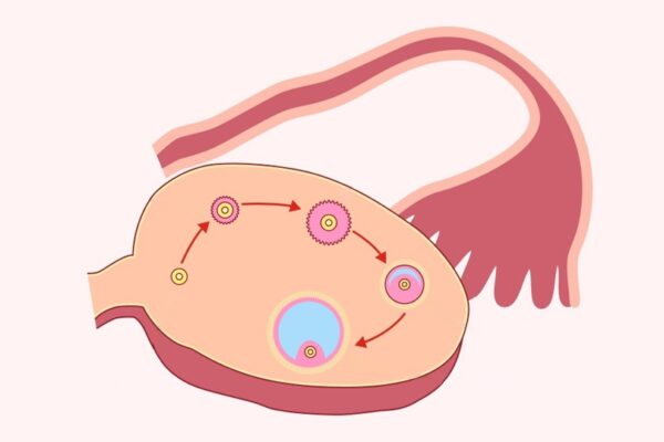 Нивото на АМХ и митохондриалната заместителна терапия